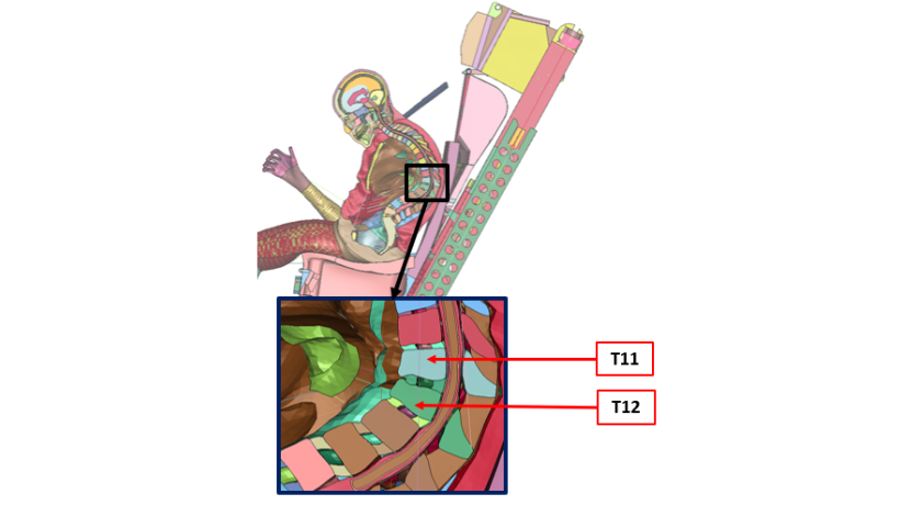 Simulation of vertebral compression du to rib cage behavior